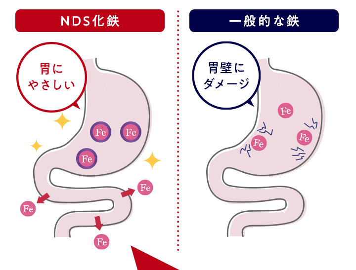 NDS化鉄 胃にやさしい | 一般的な鉄 胃壁にダメージ